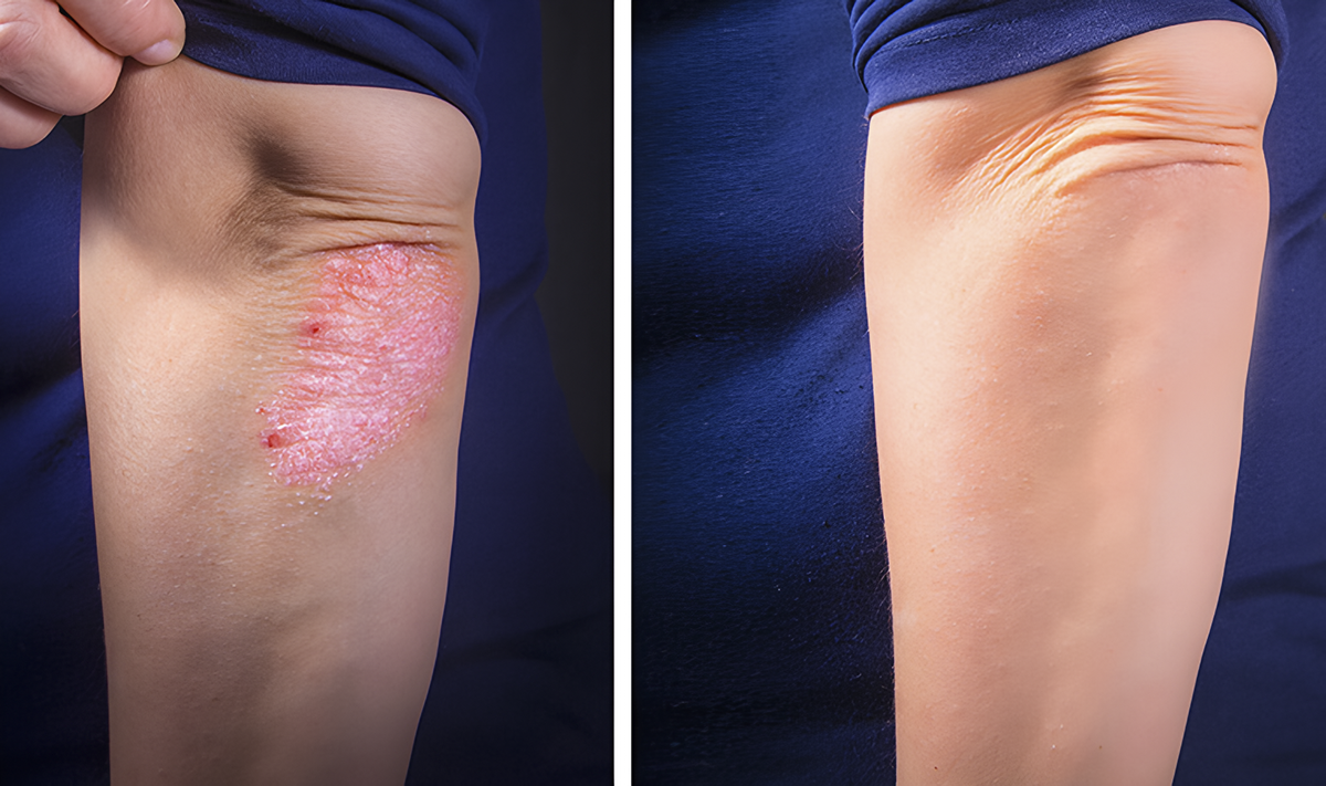 Arm before after 1