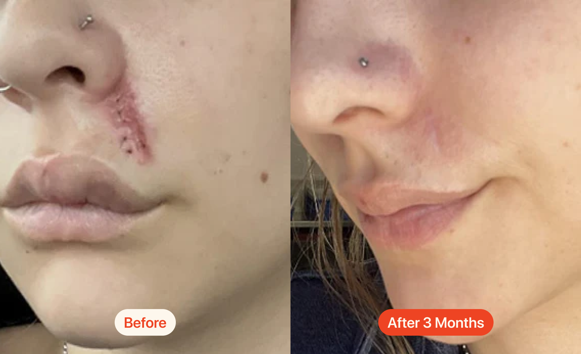 Beauty Saver Nuvadermis