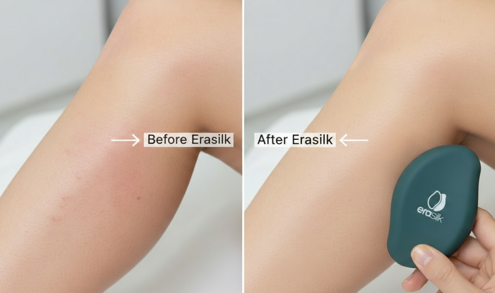 Reason2 Erasilk Advertorial 1