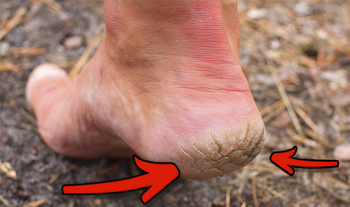 Feets advertorial 02 1