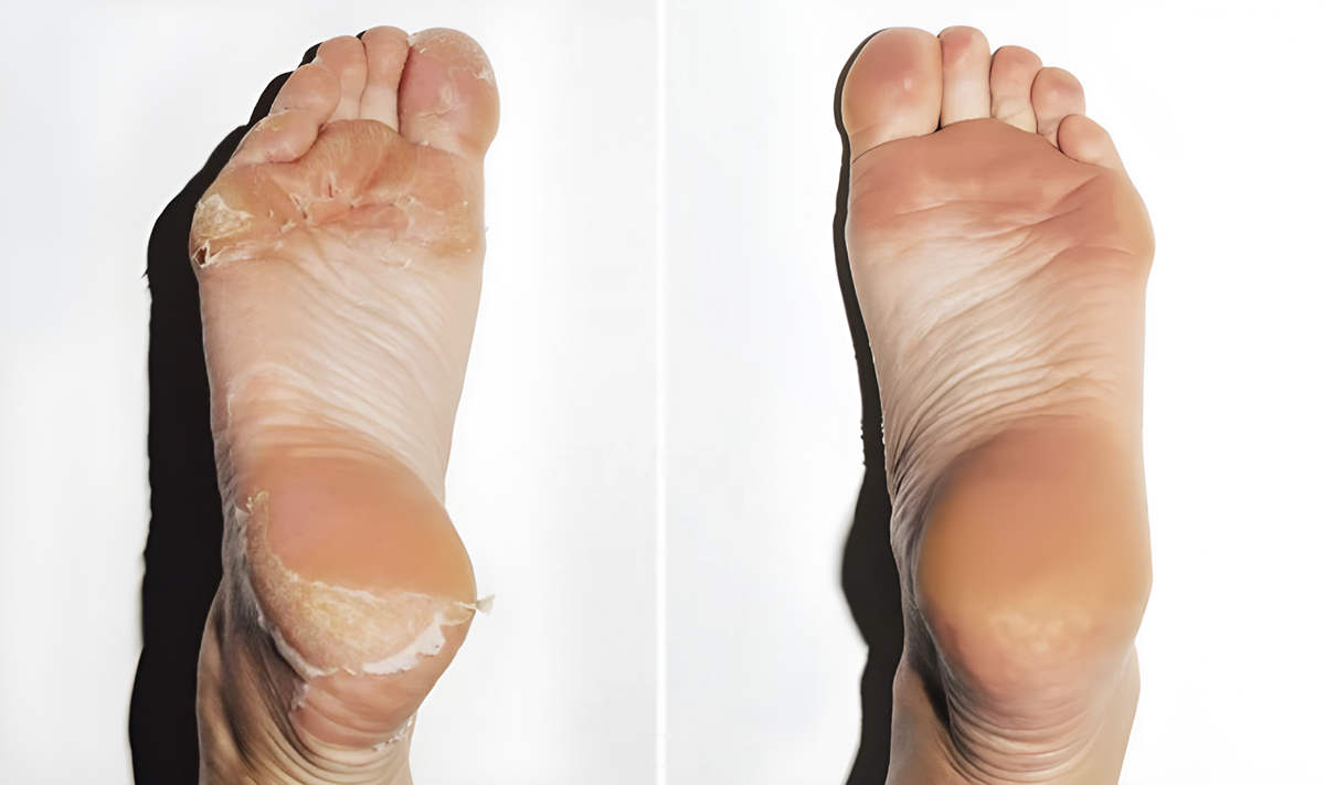 Feets advertorial 06 1