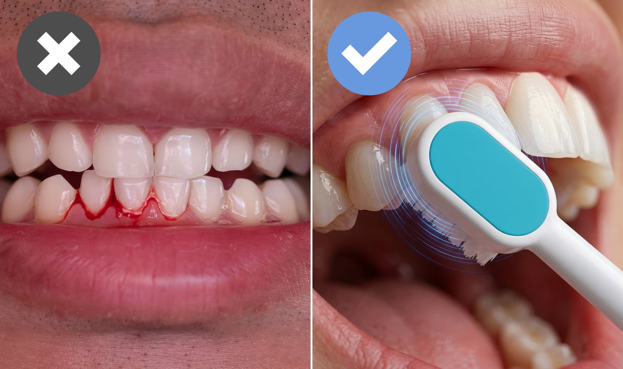 Great Gums 00