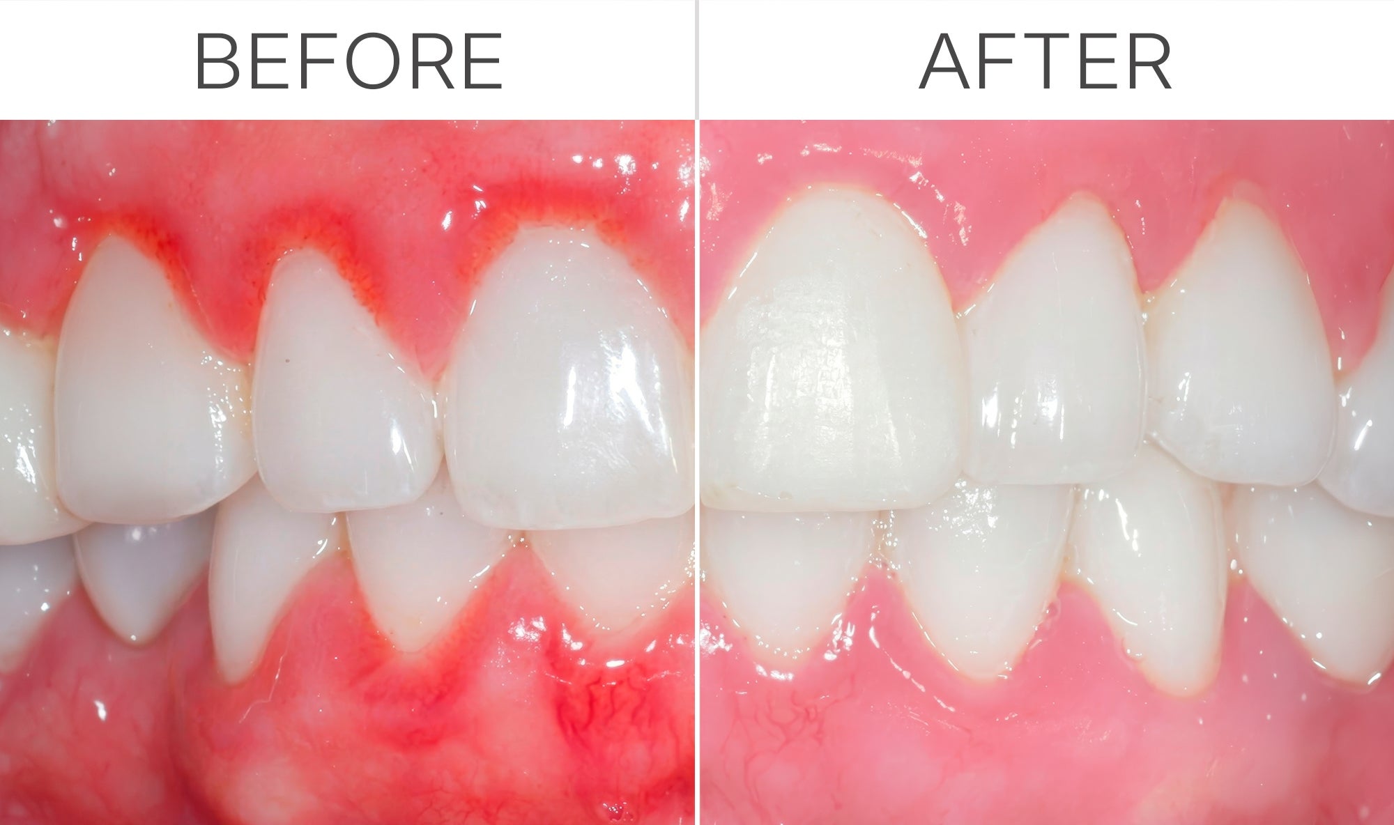 Great Gums 01