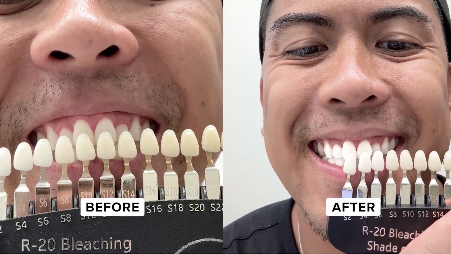 Jon before after