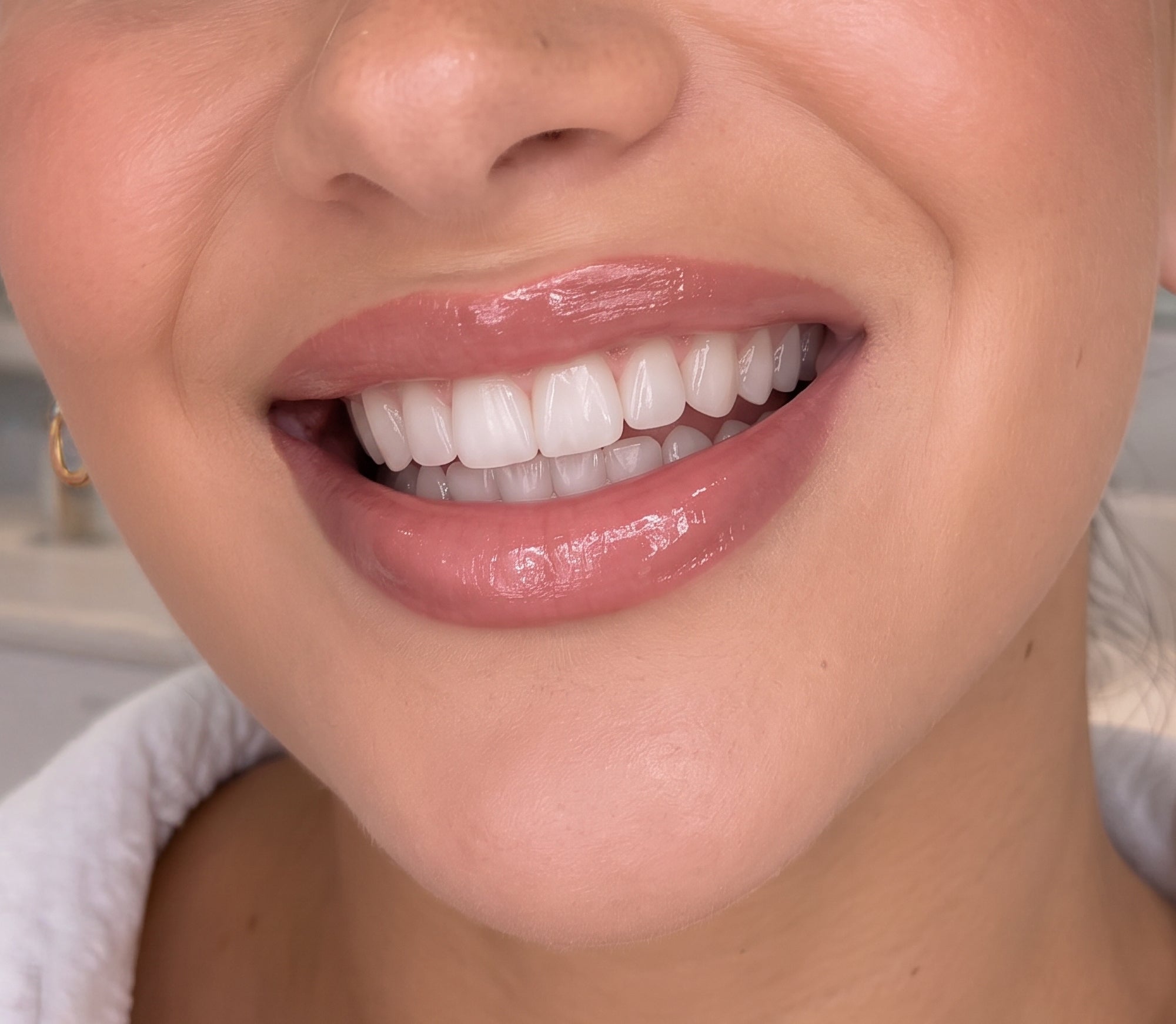 Gr02 2000x1742 Purely white deluxe strips