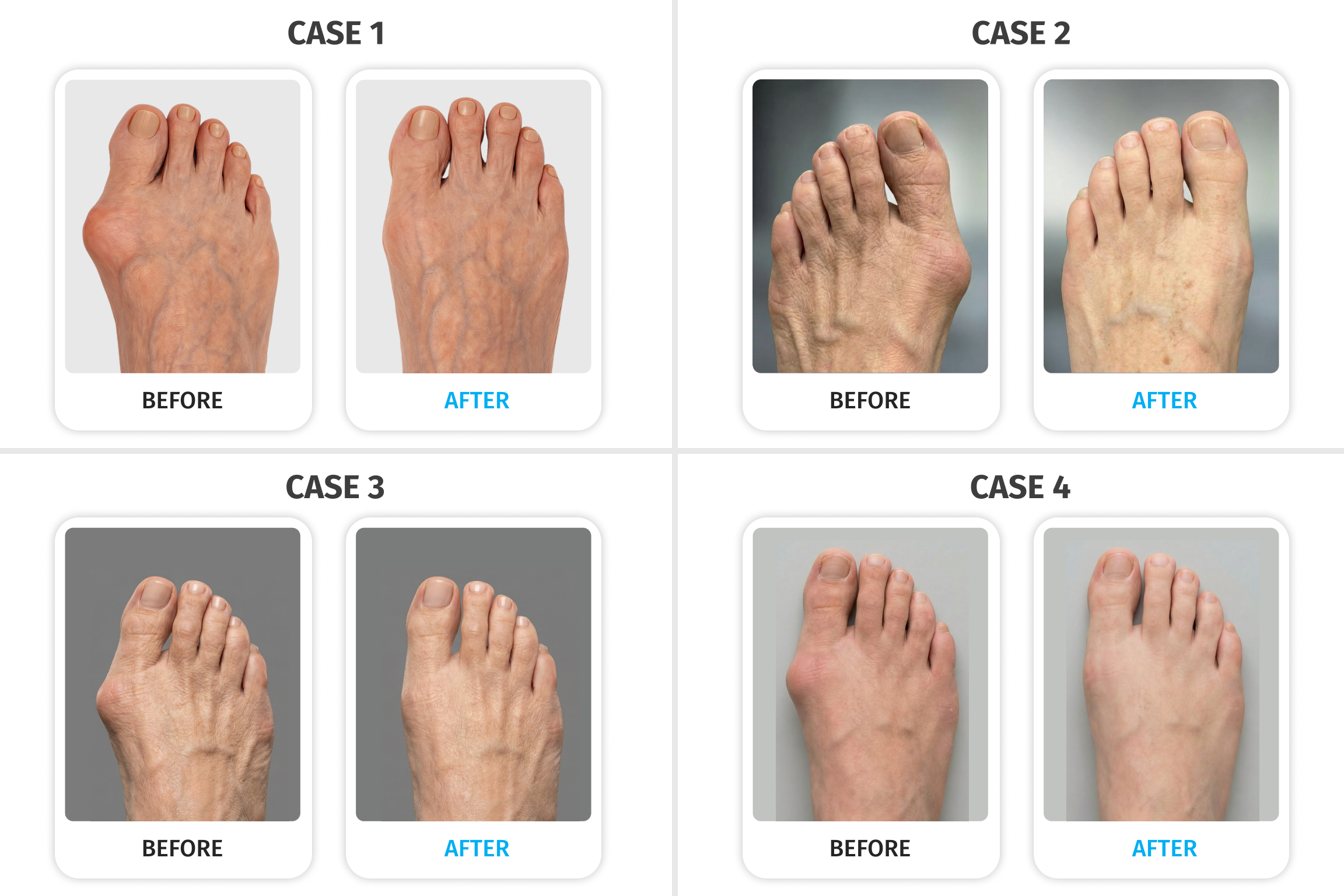 Adv 1770972748 BF THE RESULTS THAT HAVE PODIATRISTS SCRAMBLING 1
