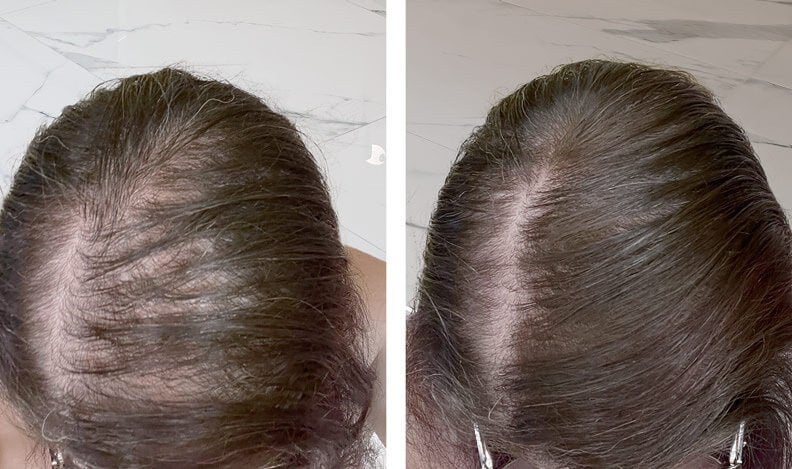 Before after 3 adv