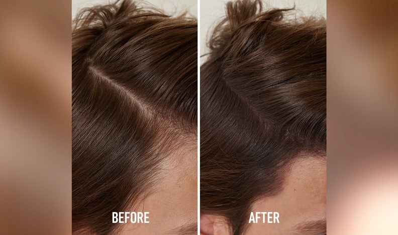 Before after