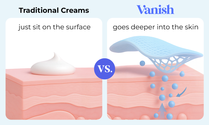 Traditional versus Vanish 1
