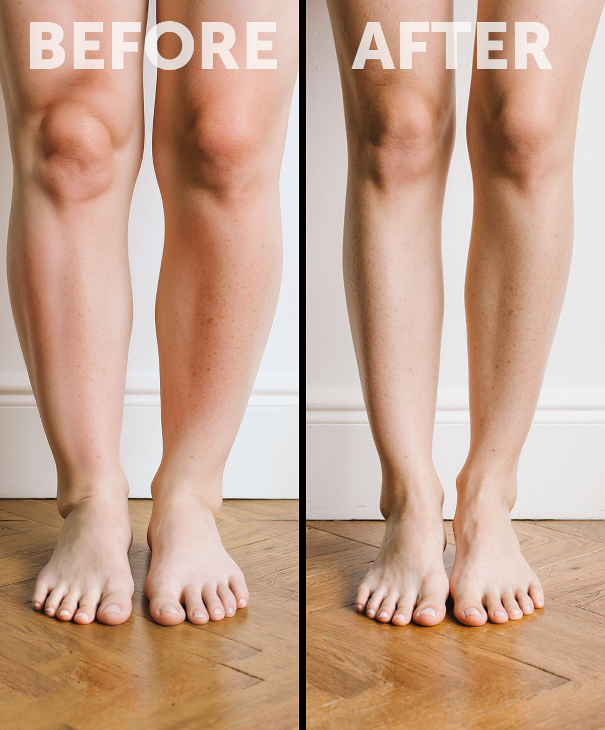 Leg swelling 03